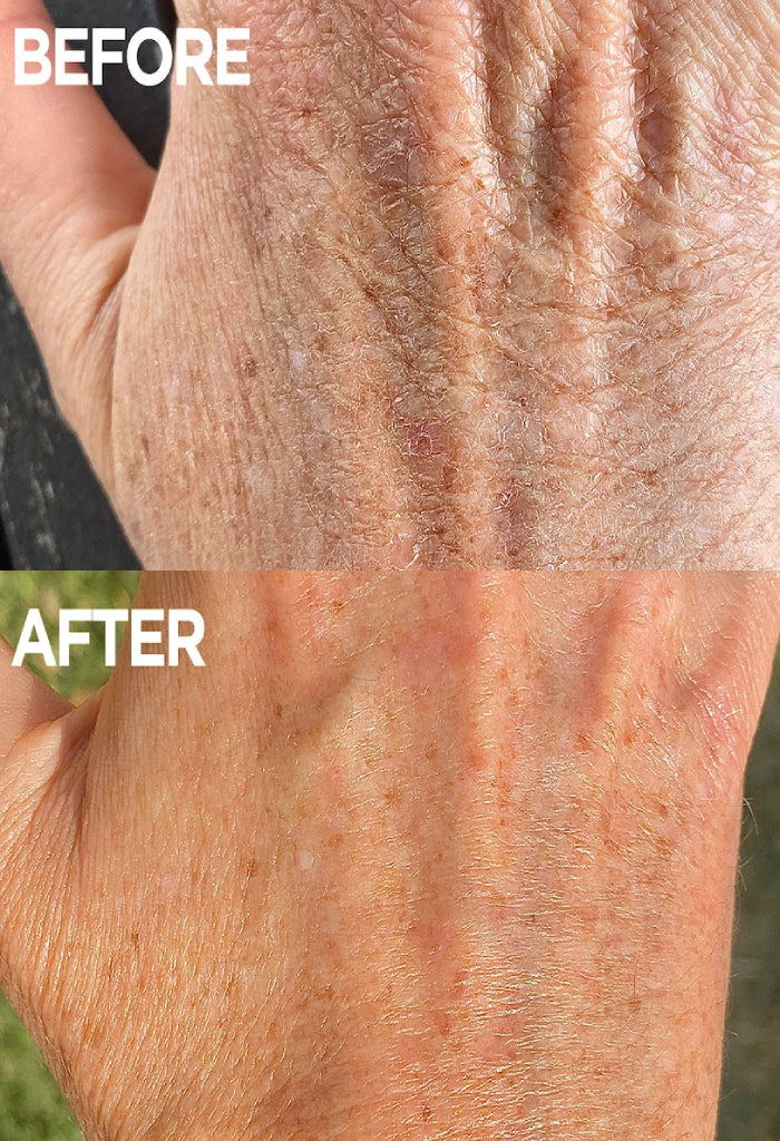 Lanolips Golden Dry Skin Miracle Salve